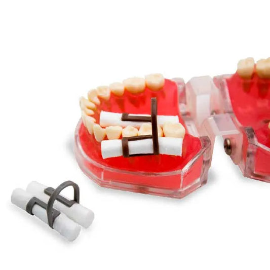 Porta Tórulas de Nylon x 10 Cotton roll clip Cotisen